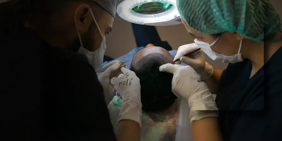 FUE Procedure